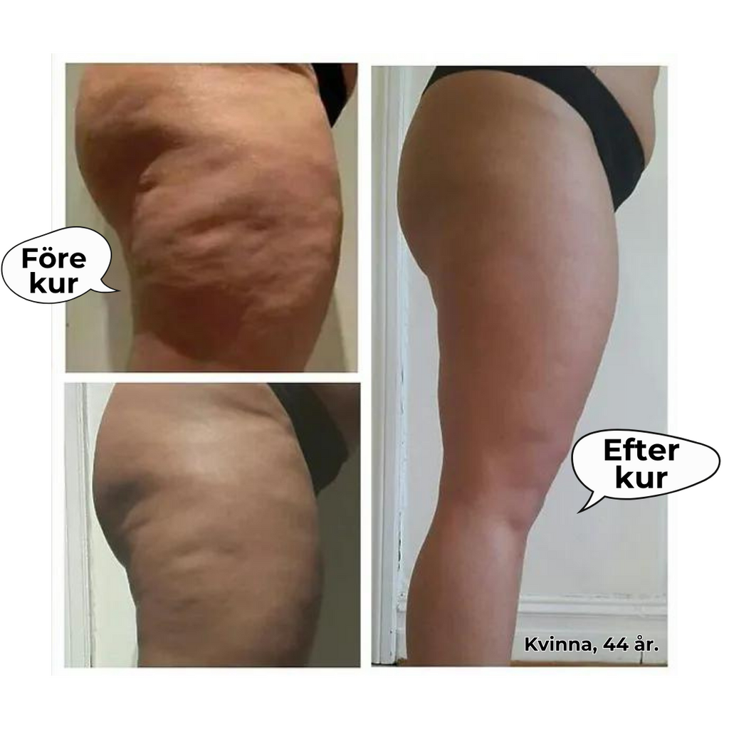 Rollmassage Jul Deal🎁