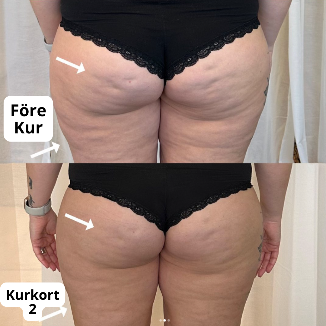 Fyll på saldo rollmassage