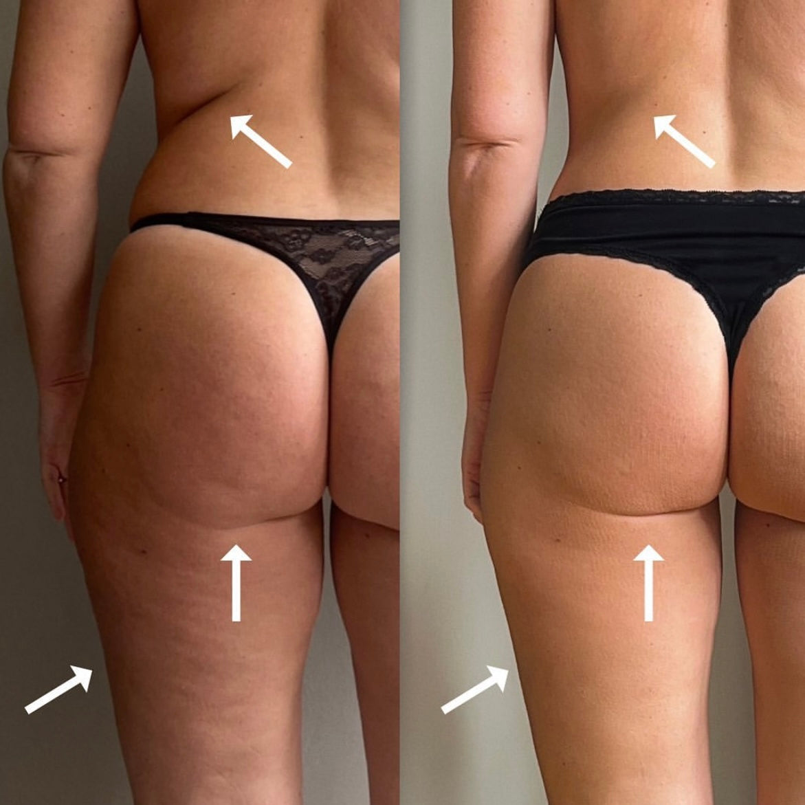 Fyll på saldo rollmassage